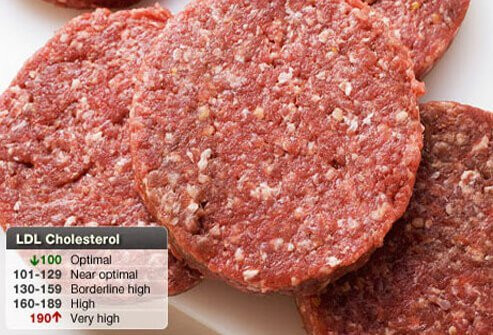 Kolesterol LDL (Low Density Lipoprotein)